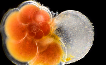 A foram, or member of the plankton group foraminifera, is a single-celled marine animal that lives inside a protective chalky shell. Photo credit - Solvin Zankl Photography